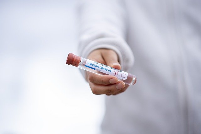 Jakie są rodzaje testów na koronawirusa?